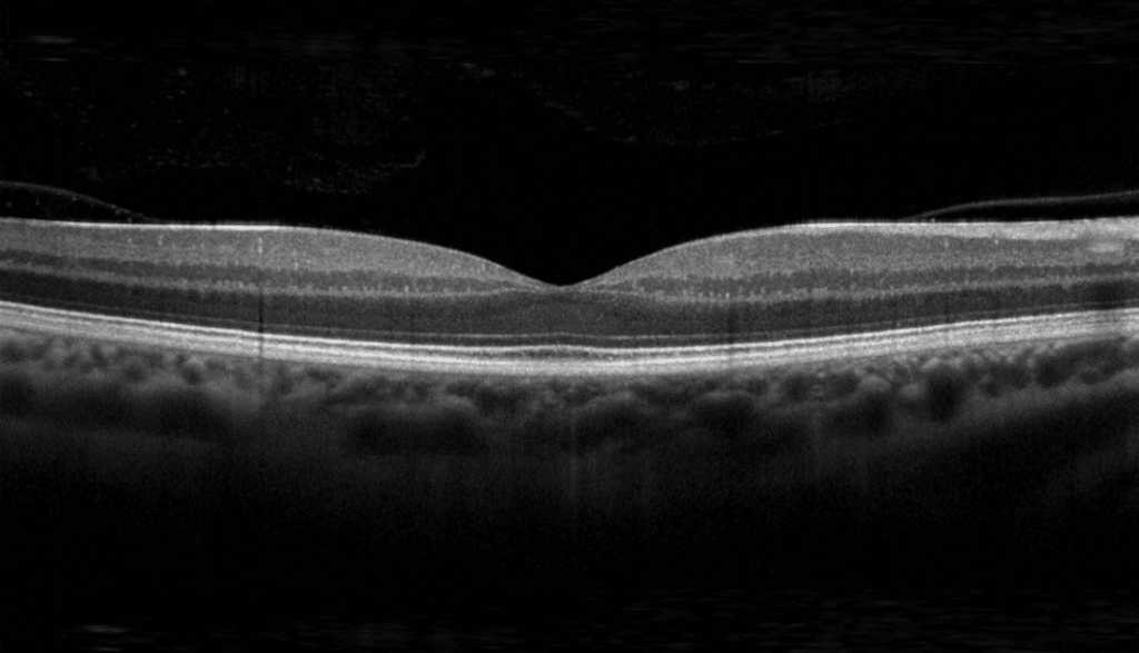Professor Jay Duker Delivers Lectures on OCT to Ophthalmologists in Ghana