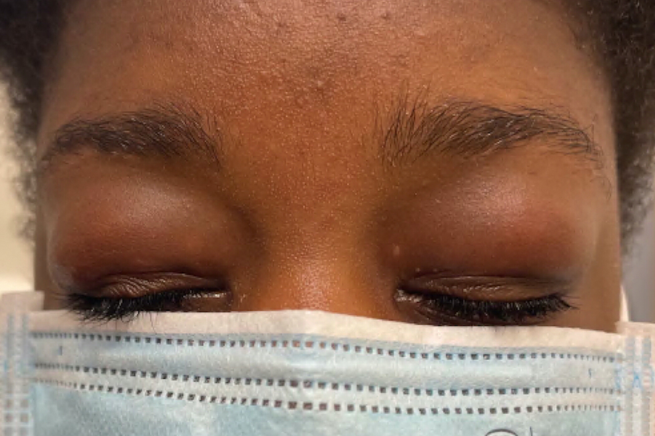 Dealing with a Swollen Eyelid? Here’s What Might Be Behind It