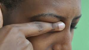 What Causes Itchy Eyes? Common Triggers and Relief Options What Causes Itchy Eyes? Common Triggers and Relief Options