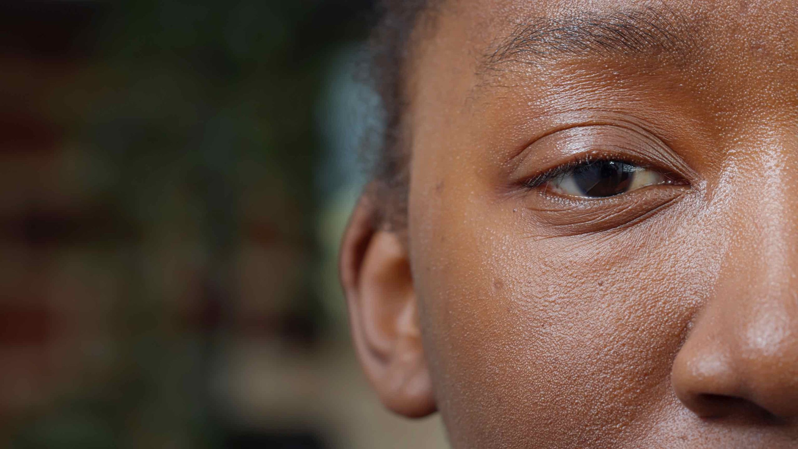 eye bags ghana