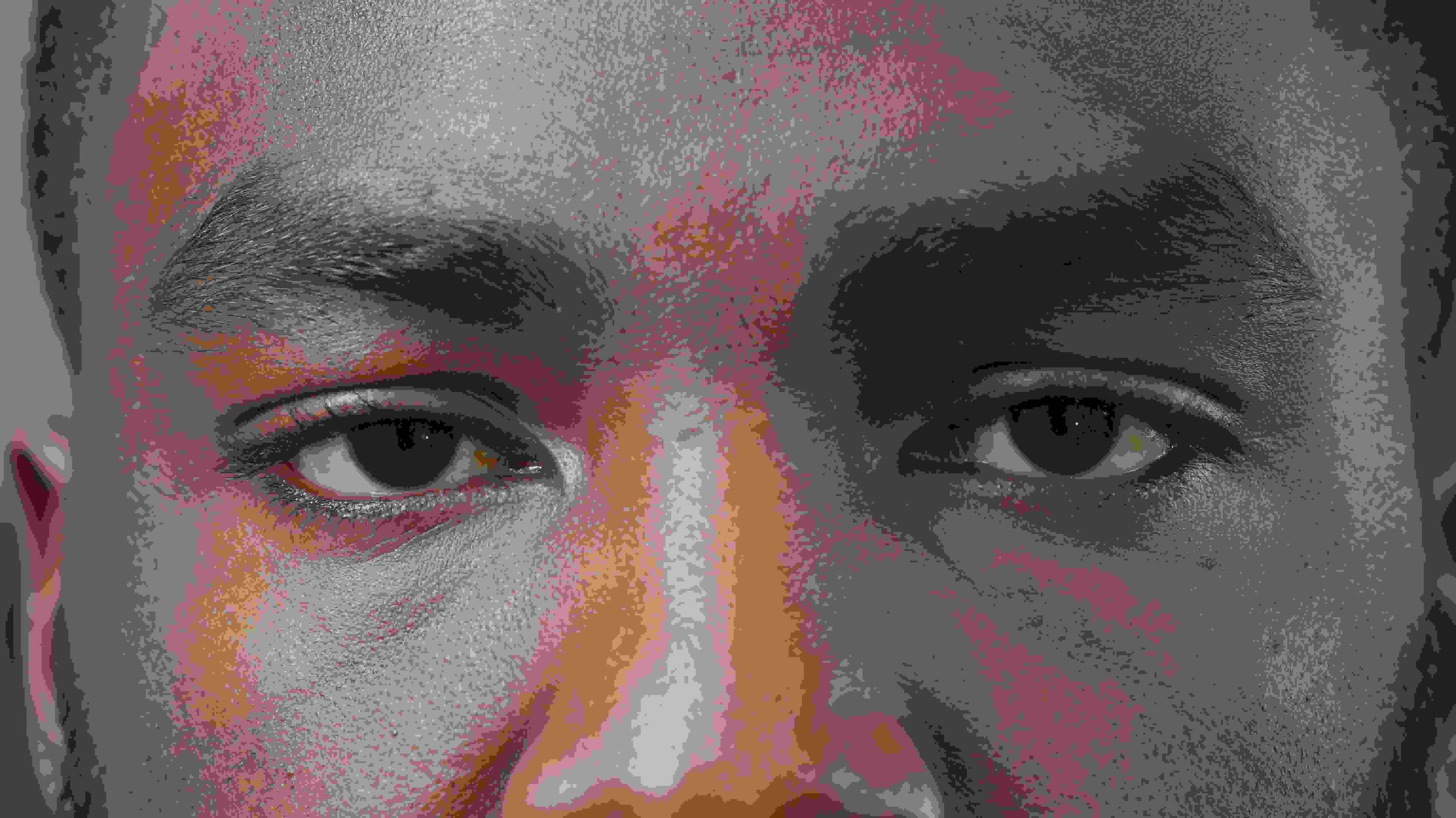 eye bags ghana